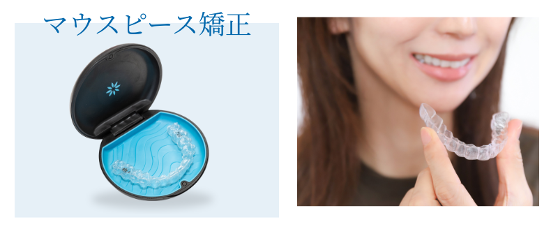 マウスピース矯正