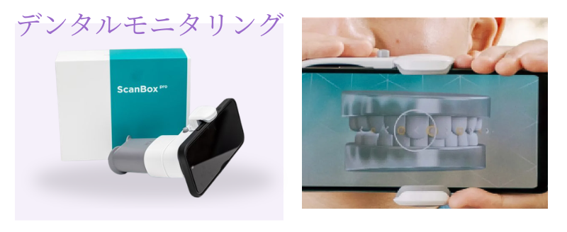 デンタルモニタリング