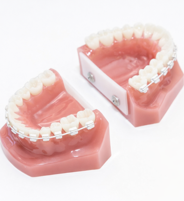 セラミックブラケット・ホワイトワイヤー