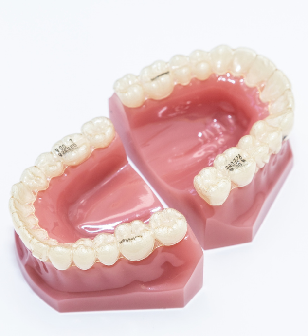 マウスピース矯正