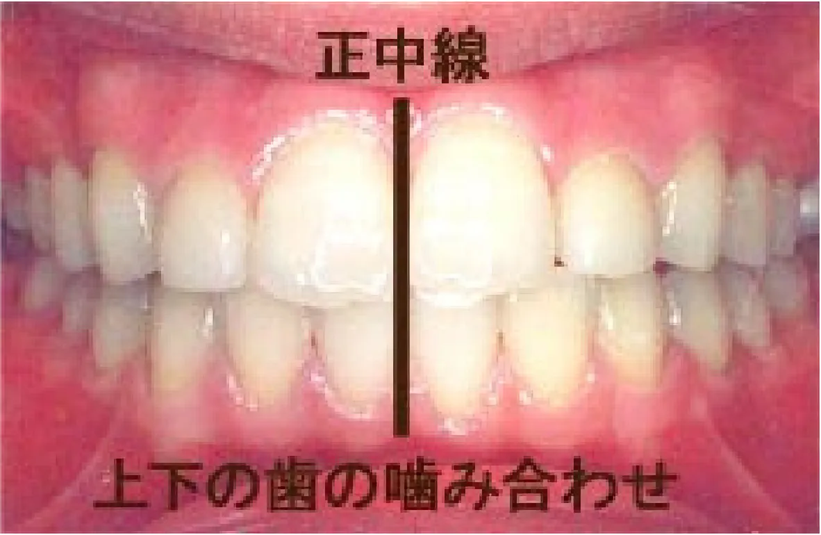 良い噛み合わせときれいな歯並びとは