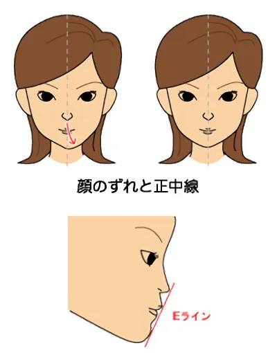 良い噛み合わせときれいな歯並びとは