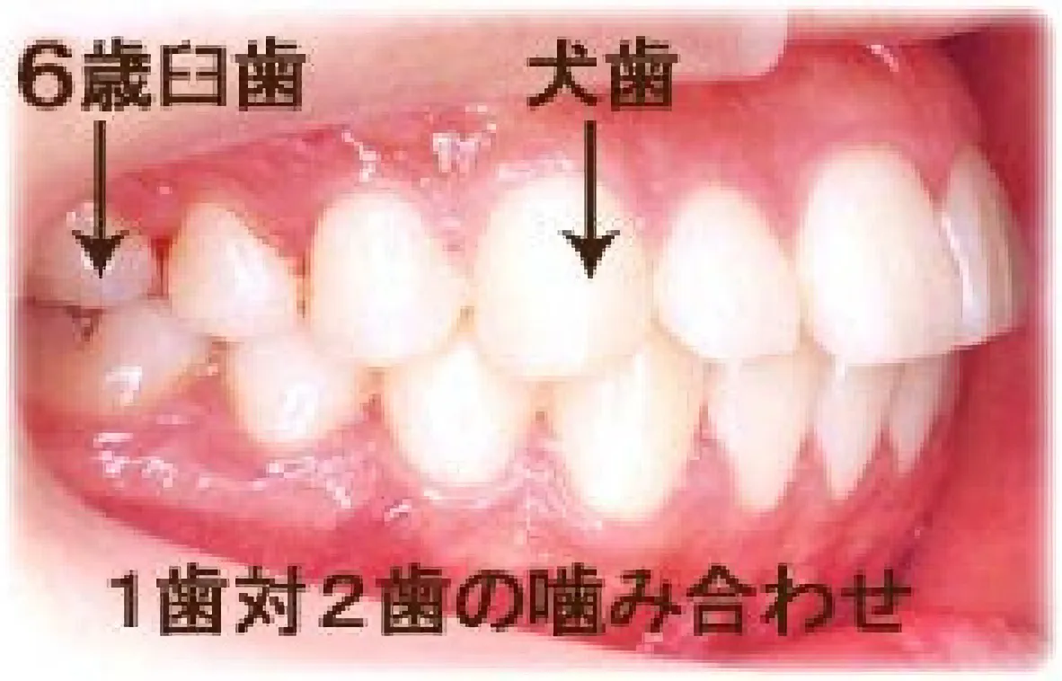 良い噛み合わせときれいな歯並びとは