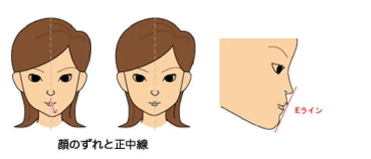 顔のズレと正中線