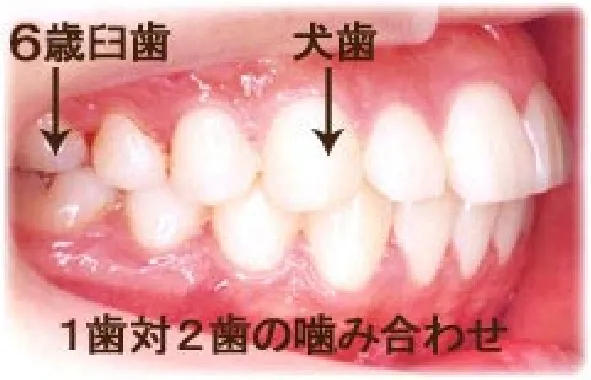 噛み合わせ