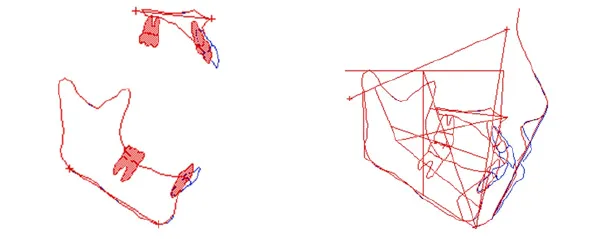 顔写真を元に予測・移動後の変化を確認