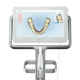 口腔内3Dスキャナー「iTeroスキャニング」装置で歯の動きの確認が可能